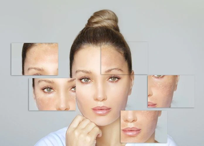 Pigmentation Removal Treatment London