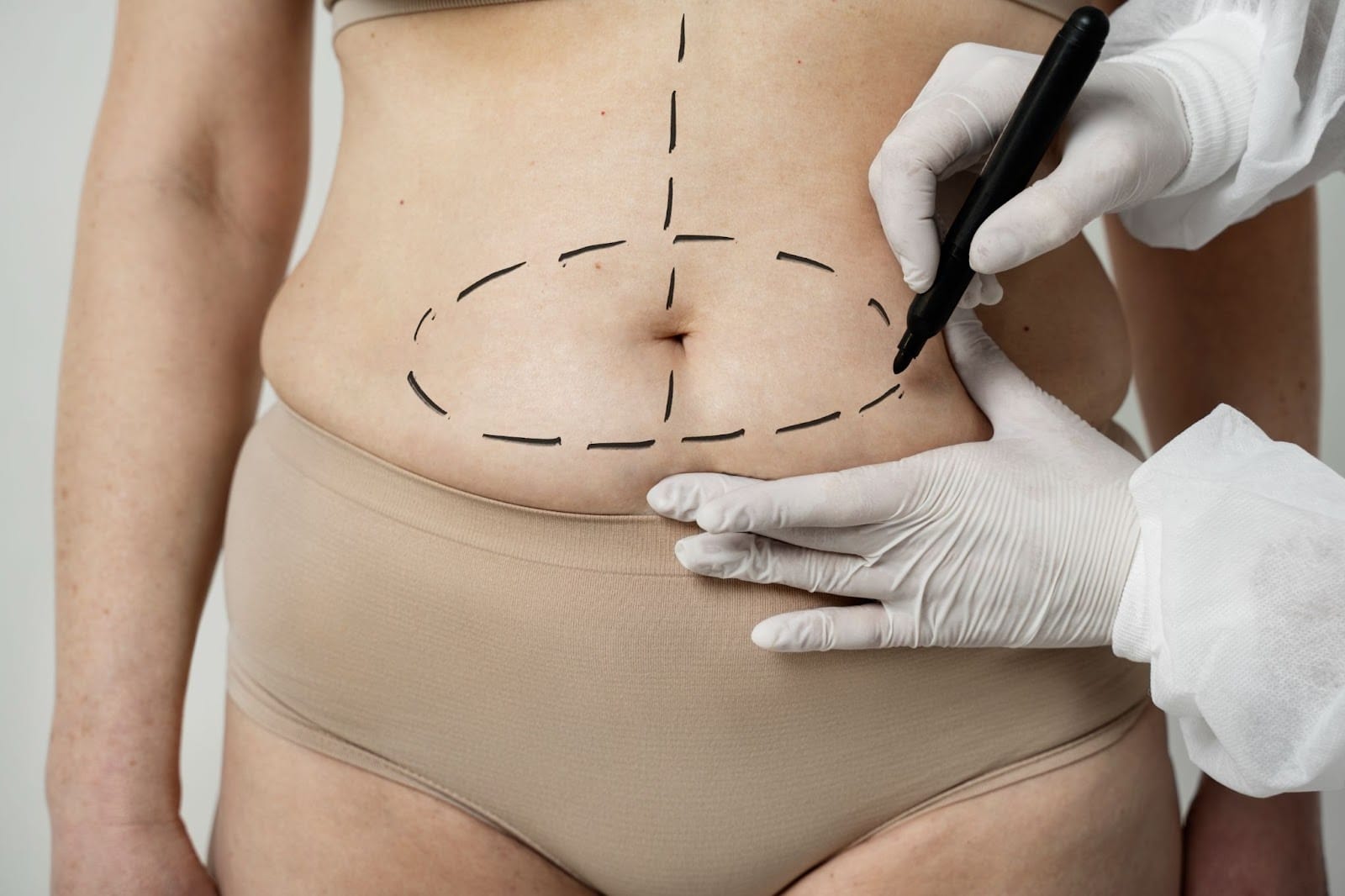 BODY CONTOURING VS LIPOSUCTION