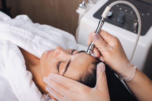 Microdermabrasion for pigmentation