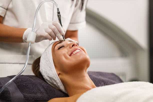 Microdermabrasion for pigmentation