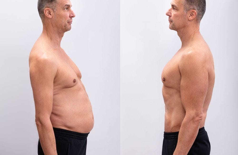 belly fat removal without surgery