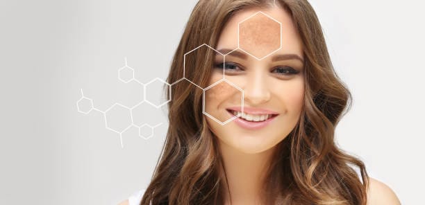 glutathione injections for hyperpigmentation