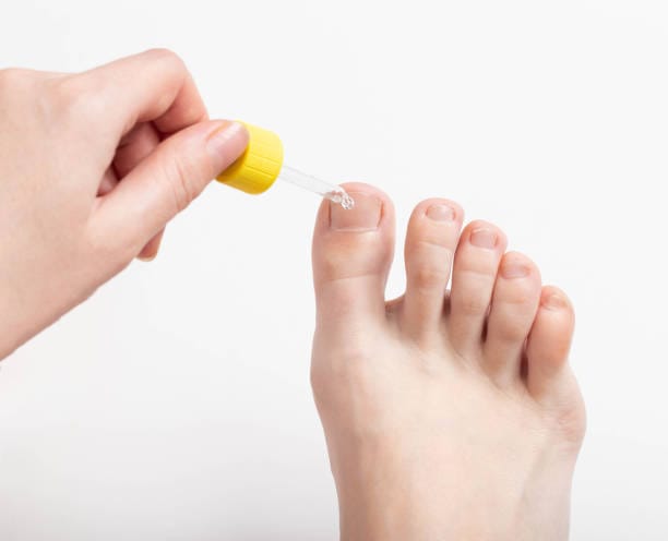 Medical Treatments for Nail Fungus