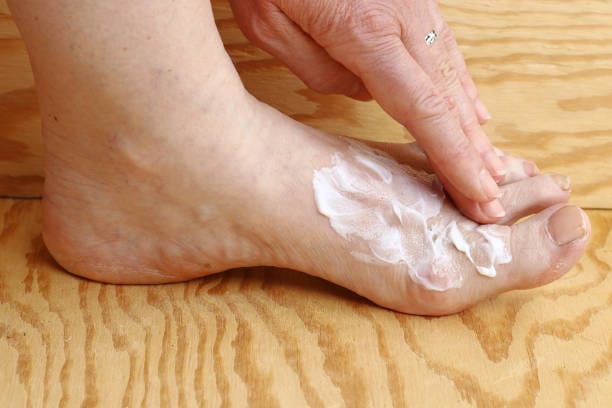 Nail Fungus Creams